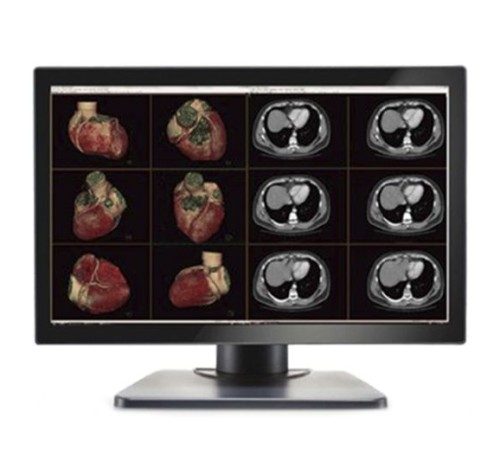 Double Black Imaging Image Systems Gemini 6MP Large Format Display Double Black Imaging Image Systems Gemini 6MP Large Format Display